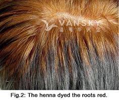 251001111036_Hair-Dying with henna-s.jpg